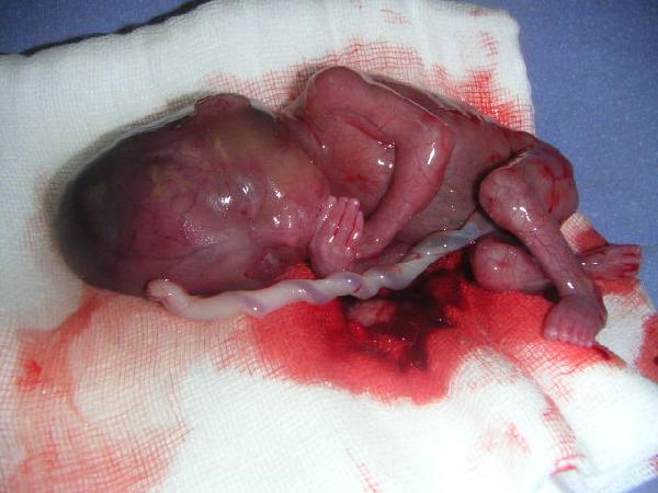 abortomid.jpg